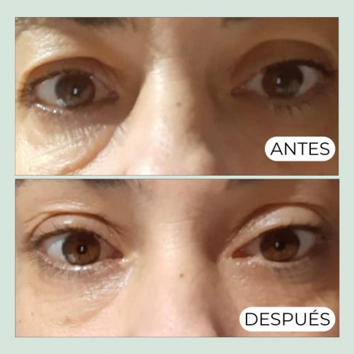 CONTORNO OJOS CONCENTRADO ANTIEDAD CON AGUACATE, TÉ VERDE & CAFEÍNA