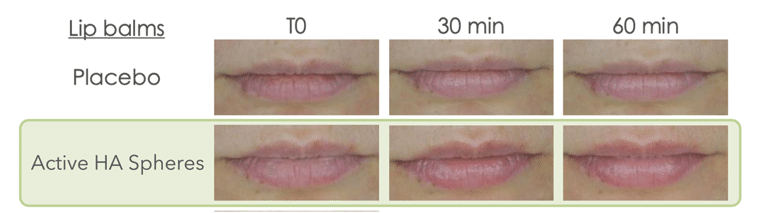 ESTUDIO IN VIVO HIDRATACIÓN DE LABIOS