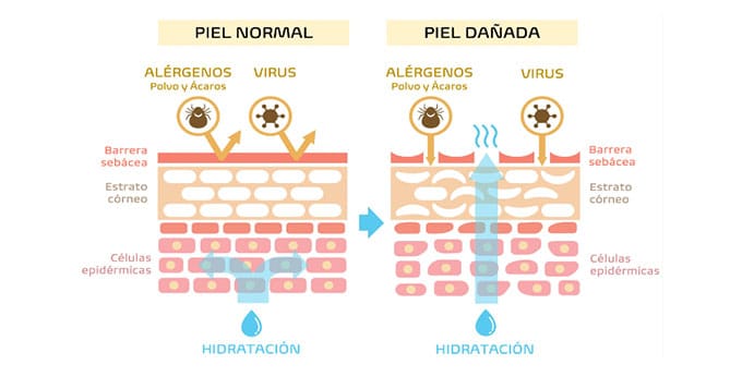 Función barrera de la piel